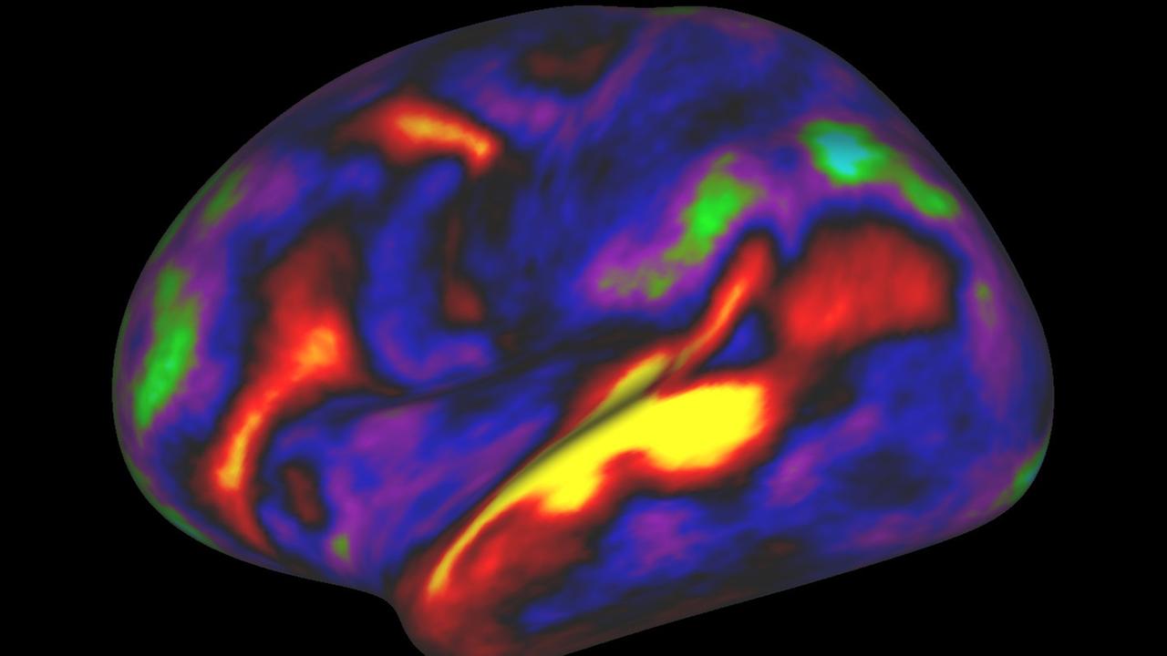 Eine Computersimulation des menschlichen Gehirns mit roten bis blauen Flächen. Je rötlicher ein Areal, desto mehr Myelin ("weiße Substanz") gibt es dort. Eine Computersimulation des menschlichen Gehirns mit roten bis blauen Flächen. Je rötlicher ein Areal, desto mehr Myelin ("weiße Substanz") gibt es dort.