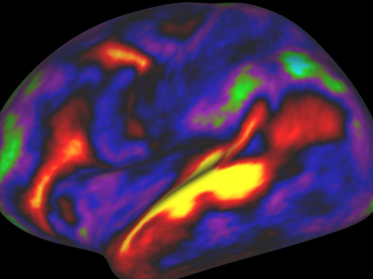 Eine Computersimulation des menschlichen Gehirns mit roten bis blauen Flächen. Je rötlicher ein Areal, desto mehr Myelin ("weiße Substanz") gibt es dort.