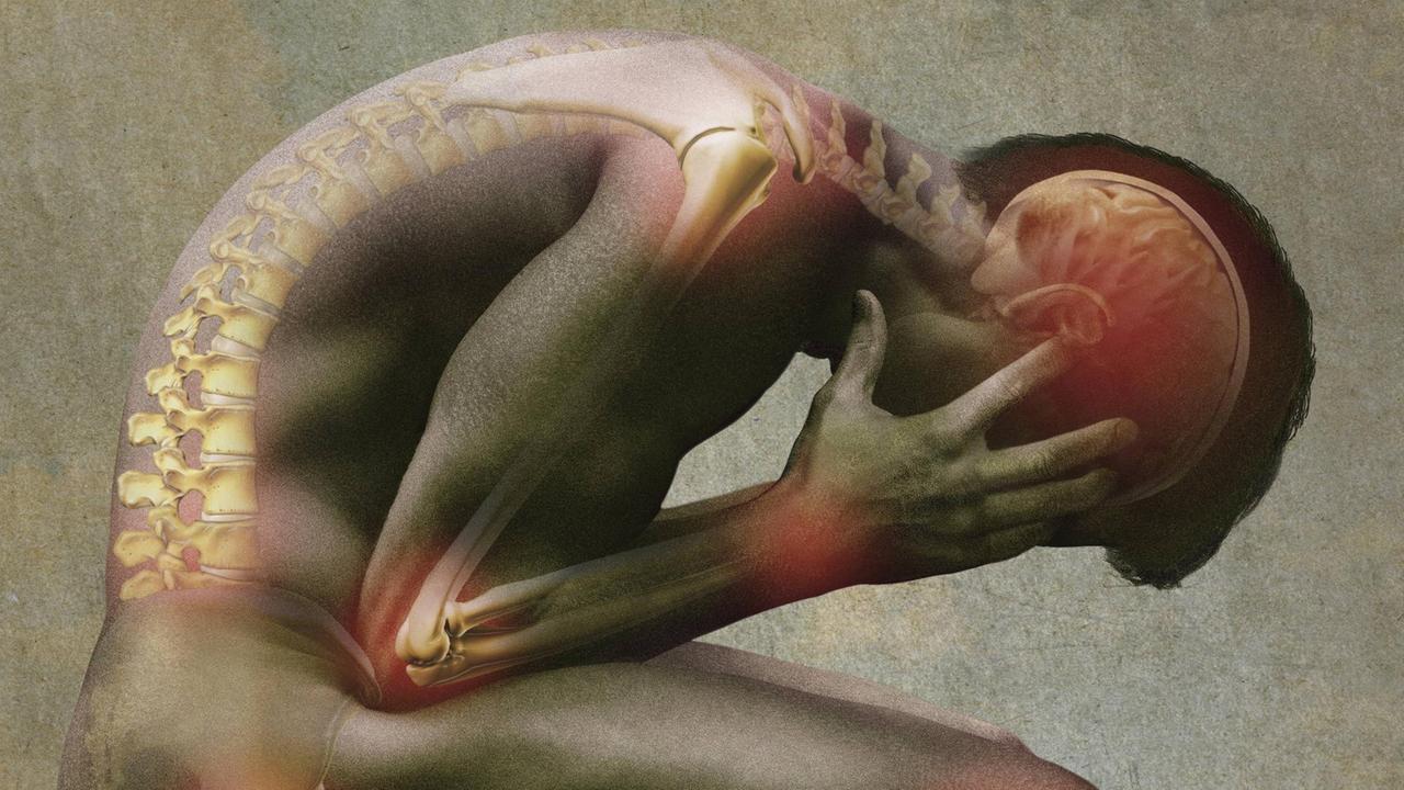 Computergeneriertes Bild eines gebeugten, an Gelenkschmerzen leidenden Mannes