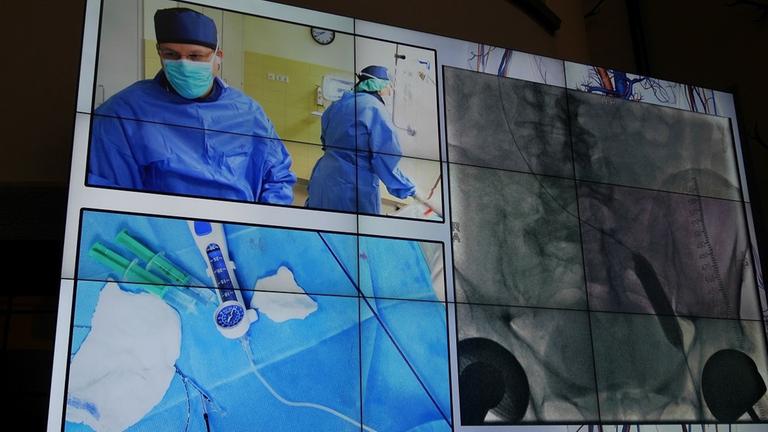 Das Bild ist vertikal zweigeteilt. Auf der linken Seite sind zwei Bilder untereinander zu sehen. Das obere Bild auf der linken Seite zeigt zwei Personen in blauer OP-Bekleidung. Im unteren Bild sieht man OP-Besteck auf einem blauen OP-Tuch. Die rechte Seite des Bildes zeigt eine Röntgen-Aufnahme eines Beckens mit einem eingesetzten Stent. Das Bild ist vertikal zweigeteilt. Auf der linken Seite sind zwei Bilder untereinander zu sehen. Das obere Bild auf der linken Seite zeigt zwei Personen in blauer OP-Bekleidung. Im unteren Bild sieht man OP-Besteck auf einem blauen OP-Tuch. Die rechte Seite des Bildes zeigt eine Röntgen-Aufnahme eines Beckens mit einem eingesetzten Stent.
