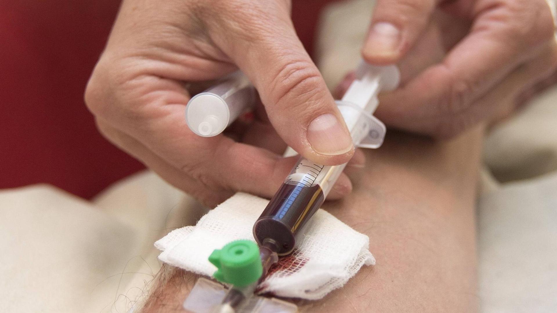 Beim Eigenblutdoping werden dem Sportler oder der Sportlerin Blut abgenommen. Die roten Blutkörperchen werden extrahiert und dem Athleten oder der Athletin kurz vor dem Wettkampf per Transfusion wieder zugeführt. Die erhöhte Konzentration von roten Blutkörperchen sorgt für einen verbesserten Sauerstofftransport. Beim Eigenblutdoping werden dem Sportler oder der Sportlerin Blut abgenommen. Die roten Blutkörperchen werden extrahiert und dem Athleten oder der Athletin kurz vor dem Wettkampf per Transfusion wieder zugeführt. Die erhöhte Konzentration von roten Blutkörperchen sorgt für einen verbesserten Sauerstofftransport.