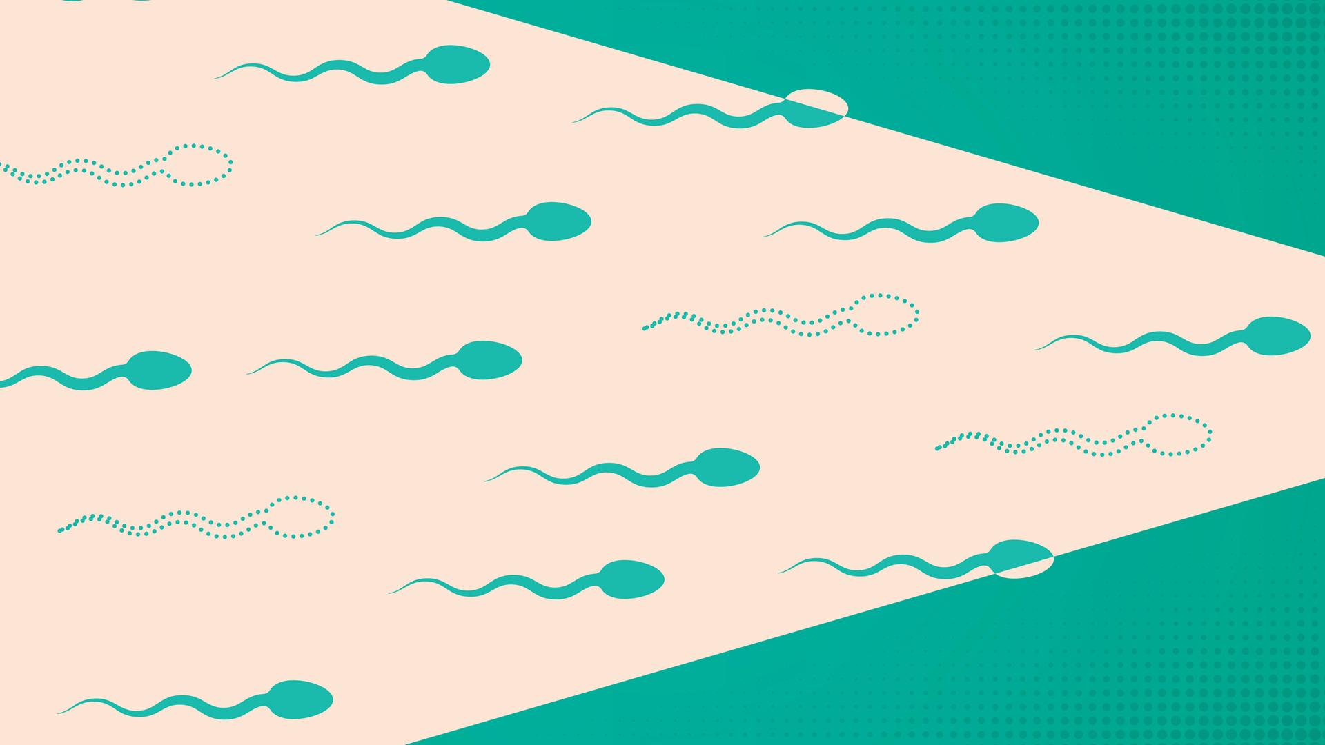 Illustration von Spermien die sich von links nach rechts bewegen.