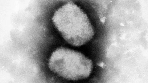 Eine vom Robert Koch-Institut (RKI) zur Verfügung gestellte elektronenmikroskopische Aufnahme zeigt das Virus, das die Affenpocken auslöst.