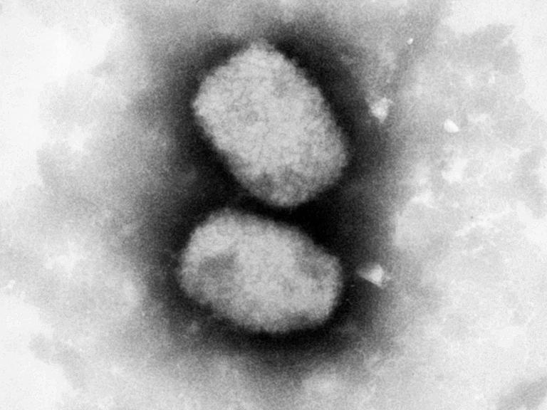 Eine vom Robert Koch-Institut (RKI) zur Verfügung gestellte elektronenmikroskopische Aufnahme zeigt das Virus, das die Affenpocken auslöst. 