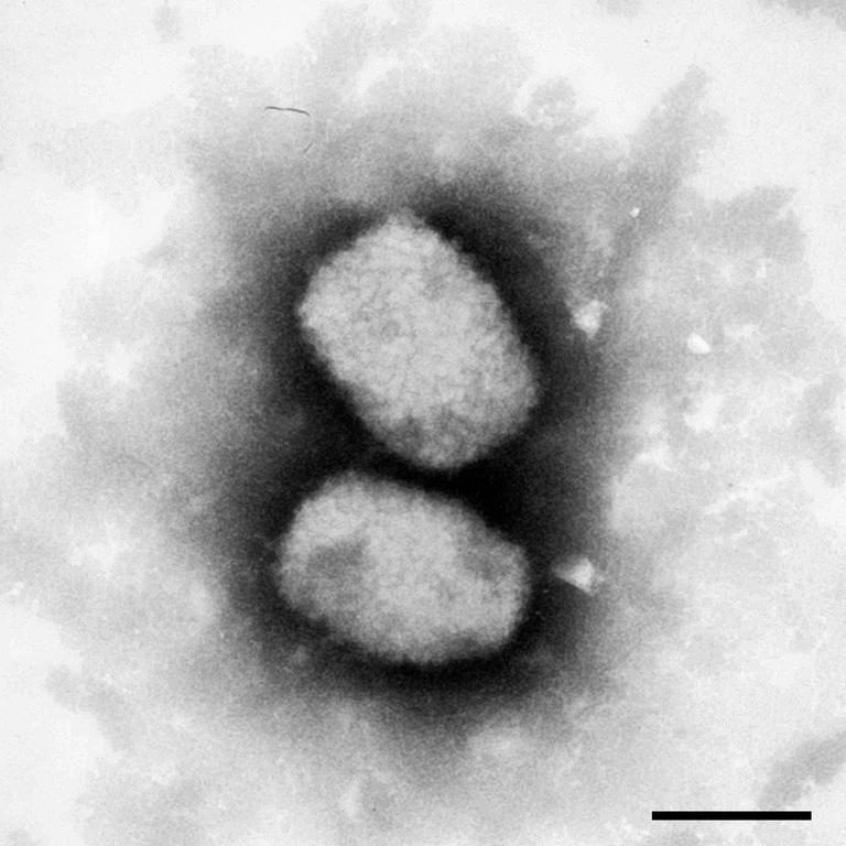 Eine vom Robert Koch-Institut (RKI) zur Verfügung gestellte elektronenmikroskopische Aufnahme zeigt das Virus, das die Affenpocken auslöst. 