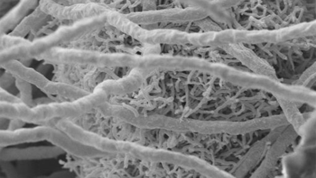 Gemeinsame Kultur des Pilzes Aspergillus fumigatus und des Bakteriums Streptomyces rapamycinicus in einer elektronenmikroskopischen Aufnahme Gemeinsame Kultur des Pilzes Aspergillus fumigatus und des Bakteriums Streptomyces rapamycinicus in einer elektronenmikroskopischen Aufnahme