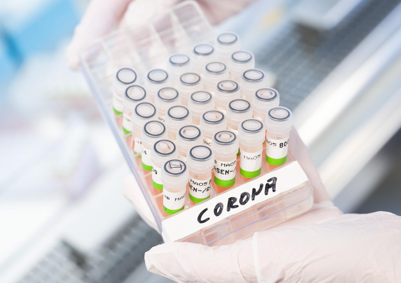Aufbereitete PCR-Tests auf das Corona-Virus, zu sehen im PCR-Labor des Niedersächsischen Landesgesundheitsamt (NLGA). Aufbereitete PCR-Tests auf das Corona-Virus, zu sehen im PCR-Labor des Niedersächsischen Landesgesundheitsamt (NLGA).