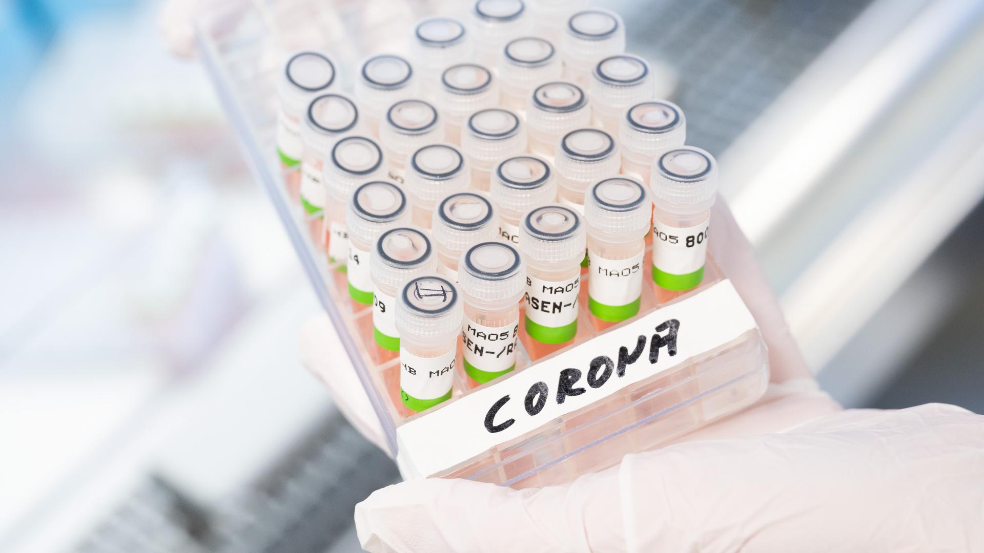 Aufbereitete PCR-Tests auf das Corona-Virus, zu sehen im PCR-Labor des Niedersächsischen Landesgesundheitsamt (NLGA).