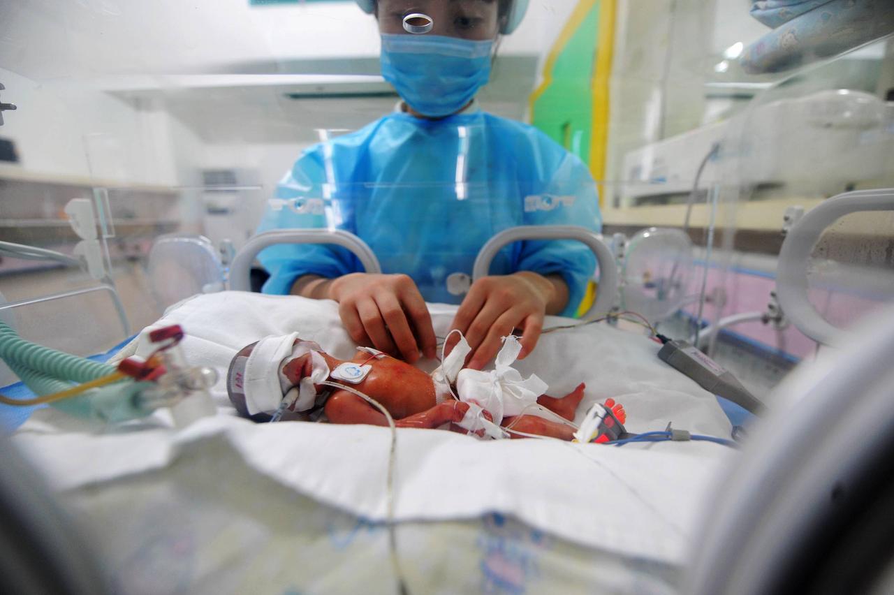 Ein Frühchen in einem Inkubator im Hunan Children's Hospital in Changsha, China Ein Frühchen in einem Inkubator im Hunan Children's Hospital in Changsha, China