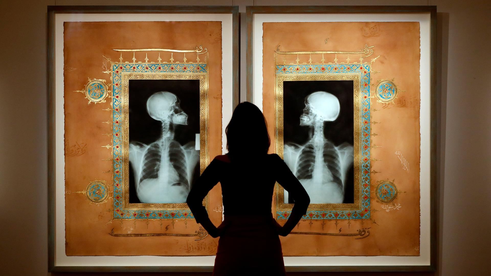 Eine Frau steht mit dem Rücken zur Kamera. Sie betrachte ein Kunstwerk, das aus den Röntgenbildern zweier zugewandter Menschen besteht.