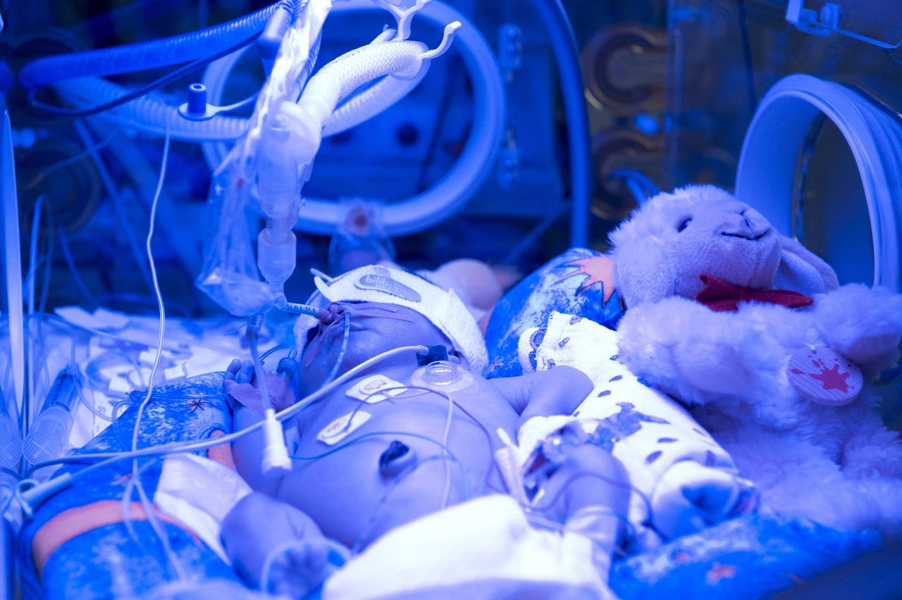 Ein Frühgeborenes wird im Säuglingsinkubator der Kinderklinik Bielefeld zur Behandlung der Neugeborenen-Gelbsucht mit blauem UV-Licht bestrahlt Ein Frühgeborenes wird im Säuglingsinkubator der Kinderklinik Bielefeld zur Behandlung der Neugeborenen-Gelbsucht mit blauem UV-Licht bestrahlt