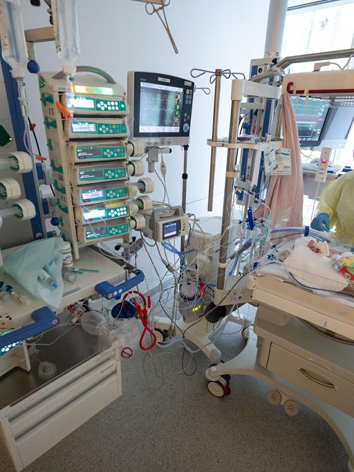 Intensivpflegerinnen pflegen auf der Kinder-Intensivstation des Olgahospitals des Klinkums Stuttgart einen am Respiratorischen Synzytial-Virus (RS-Virus oder RSV) erkrankten Patienten, der beatmet wird.