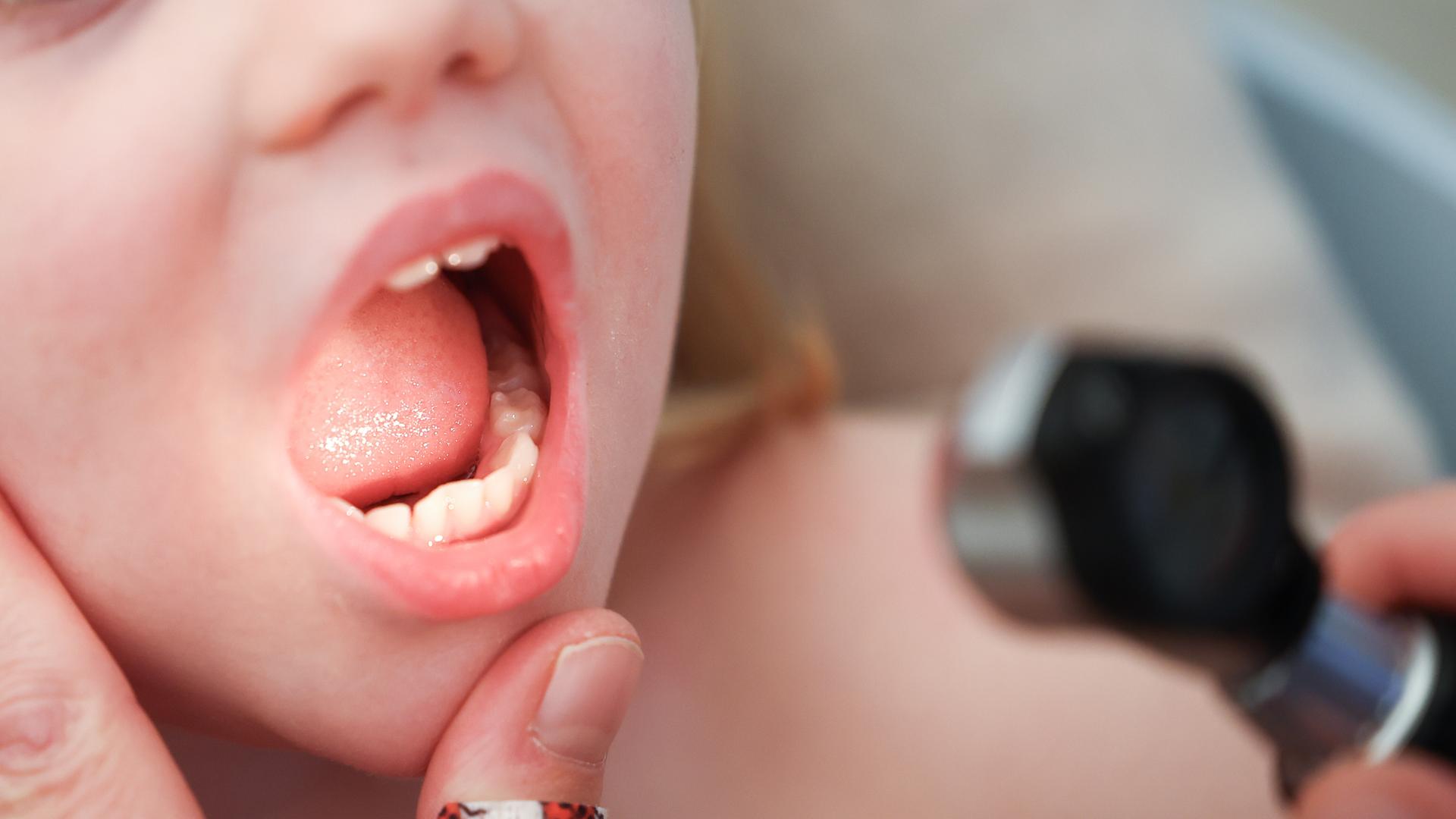 Mit einem Otoskop untersucht eine Kinderärztin den Mund und Hals eines Mädchens. Mit einem Otoskop untersucht eine Kinderärztin den Mund und Hals eines Mädchens.