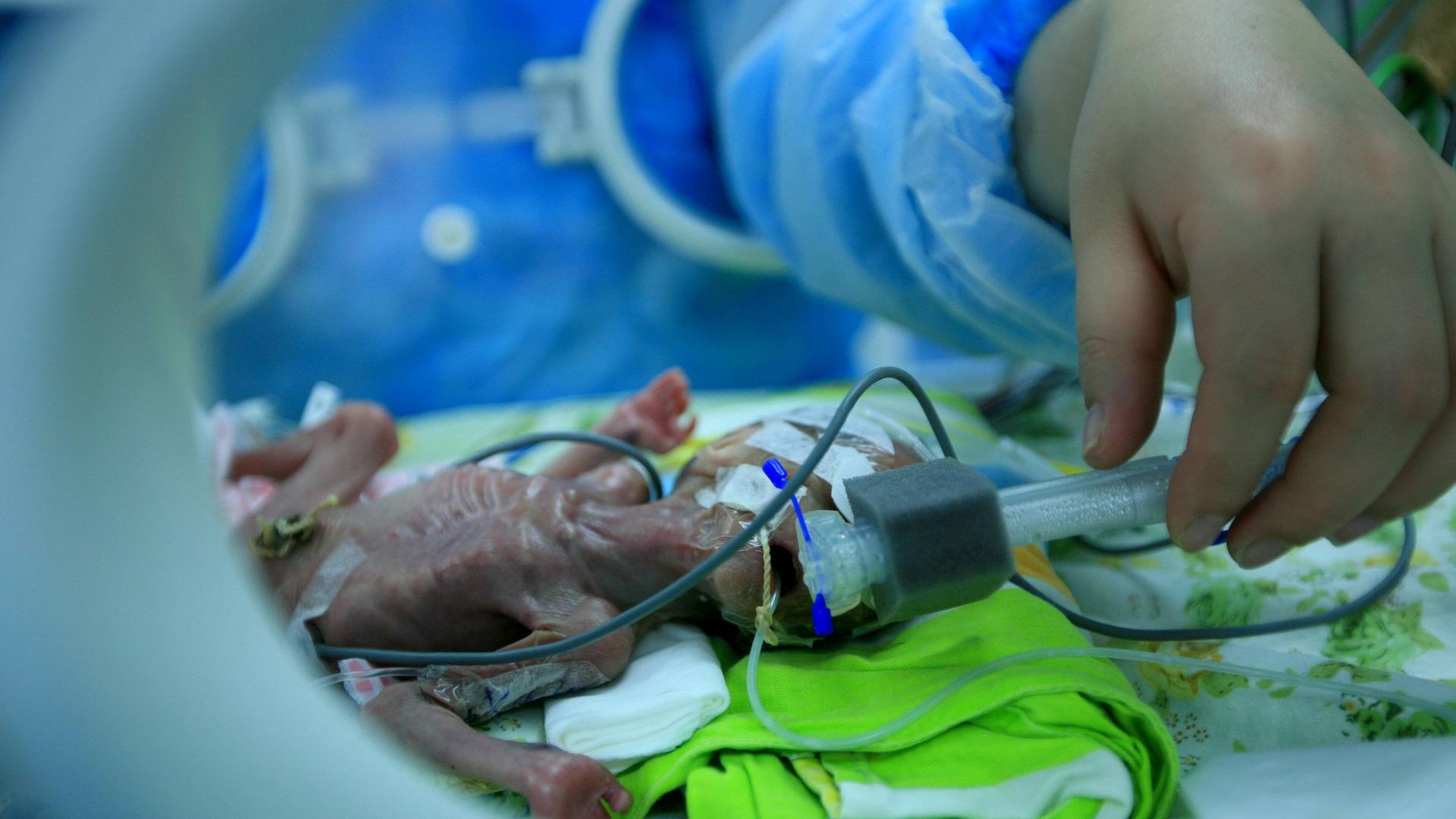 Eine Krankenschwester kümmert sich um ein Frühchen in einem Inkubator im "Affiliated Hospital of Hubei Institute for Nationalities" in Enshi, China Eine Krankenschwester kümmert sich um ein Frühchen in einem Inkubator im "Affiliated Hospital of Hubei Institute for Nationalities" in Enshi, China