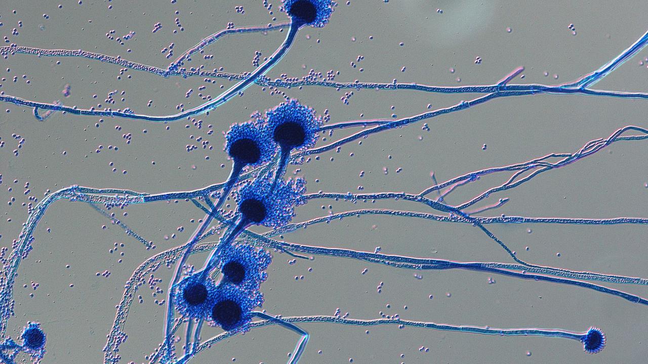 Mikroskopische Aufnahme von Sporenträgern des humanpathogenen Pilzes Aspergillus fumigatus Mikroskopische Aufnahme von Sporenträgern des humanpathogenen Pilzes Aspergillus fumigatus