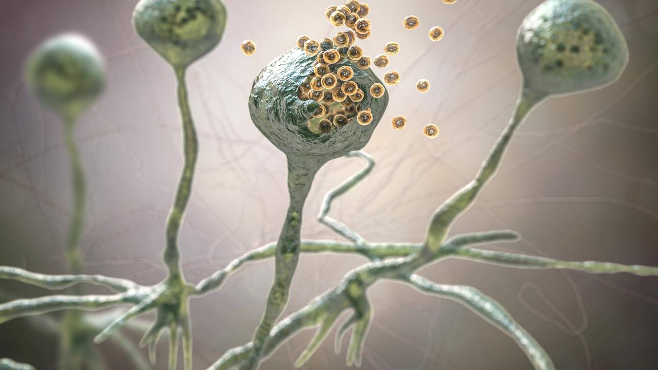 Sporen des Pilzes Rhizopus fungus (Illustration) - bestimmte Rhizopus-Arten können speziell bei Menschen mit geschwächtem Immunsystem eine Mucormykose auslösen. "Black fungus"-Infektionen während der Covid-Pandemie führten 2021 in Indien zu tausenden Todesfällen. Sporen des Pilzes Rhizopus fungus (Illustration) - bestimmte Rhizopus-Arten können speziell bei Menschen mit geschwächtem Immunsystem eine Mucormykose auslösen. "Black fungus"-Infektionen während der Covid-Pandemie führten 2021 in Indien zu tausenden Todesfällen.
